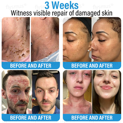 ✅ Made and Shipped from the UK | flysmus® Botox Repair Cream 🧑🏼‍⚕️ Anti-aging, Skin Repair, Acne and Dark Spot Treatment, Wart and Mole Removal, and Psoriasis Treatment🍀